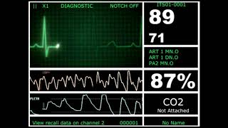 Hospital Monitor with FlatLine L HD [upl. by Barbra]