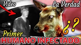 Primer Humano Zombie Captado en Video Infectado por el Virus del Ciervo Zombie [upl. by Wolsky]