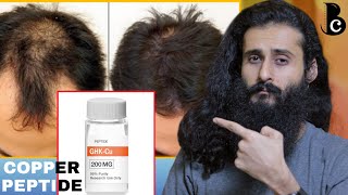 Copper Peptide Copper Tripeptide 1 GHKCu amp Hair Growth  All You Need To Know  Bearded Chokra [upl. by Arracat]