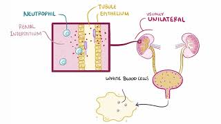 Acute Pyelonephritis  Renal Pathology  Osmosis [upl. by Debora]