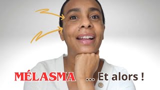 MES TACHES HORMONALES SE SONT UNE NOUVELLE FOIS INVITÉES Et je men fiche totalement [upl. by Icram]