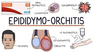 EpididymoOrchitis  epididymis [upl. by Ivan]