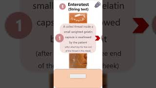 Enterotest String test  Giardia lamblia parasitology microbiology pathology protozoa neet [upl. by Evey529]