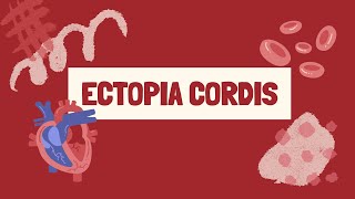 ECTOPIA CORDIS [upl. by Autry]