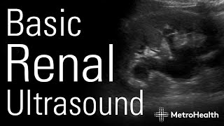 Basic Renal Ultrasound [upl. by Esilana392]