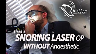 NightLase  Somnilase  Snoring Laser WITHOUT anaesthetic [upl. by Aserej]