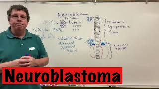 Neuroblastoma [upl. by Sommer]