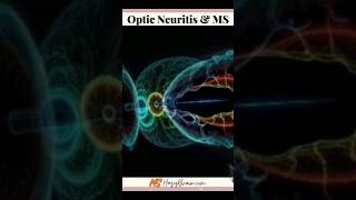 How To Recognize Optic Neuritis And MS [upl. by Llevol]