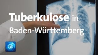 Tuberkulose Schüler und Lehrer in BadenWürttemberg erkrankt [upl. by Wobniar]