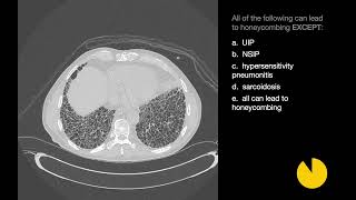 26 Cases of Interstitial Lung Disease  Xrays amp CT Scans [upl. by Alyse838]