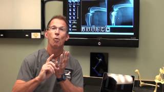 Canine ACL Tears and TPLO Surgery discussed by Dr Bauer DVM DACVS [upl. by Akli351]