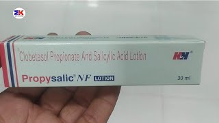 Propysalic NF Lotion  Clobetasol Propionate and Salicylic Acid Lotion  Propysalic NF Lotion Uses [upl. by Mariellen]