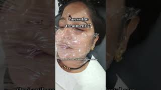 Treatment dr treatment skincare glowingskin drrichadubey viral trending besttherapy [upl. by Tdnerb]