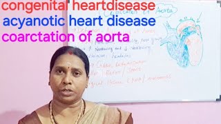 congenital heart diseaseacyanotic heart diseasecoarctation of aortapediatricsmedical surgical [upl. by Menzies]