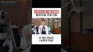 탈모치료 모낭주사 뉴헤어에서는 환자별 맞춤형으로 합니다 [upl. by Anirtek]