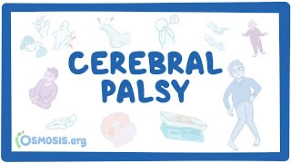 Cerebral palsy CP  causes symptoms diagnosis treatment pathology [upl. by Jean-Claude]