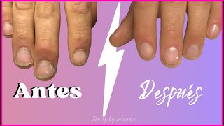 ⚒️ Manicura para hombre  mirá este ANTES y DESPUÉS 😨 [upl. by Ratha]