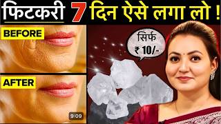 10 रूपए की चीज़ से Skin की सारी मुश्किल आसान  Facial Hair झाइयाँ Hyperpigmentation Wrinkles amp More💕 [upl. by Ahseikan459]