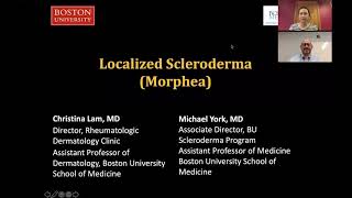 Localized Scleroderma Morphea Christina Lam MD Michael York MD [upl. by Lishe]