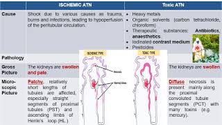 Kidney 3 Tubular amp Tubulo interstitial diseases [upl. by Jordon]