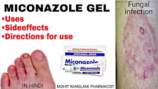 Miconazole nitrate cream  Uses sideeffects directions  Fungal infection treatment in Hindi [upl. by Wat]