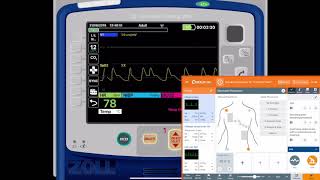 REALITi 360 14 12 Lead ECGs [upl. by Zerelda]