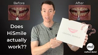 HiSmile Review By A Dentist Dr Grant McGrath [upl. by Lilac]