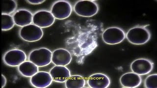 LIVE BLOOD ANALYSIS NEUTROPHILS PART 2 [upl. by Oba287]