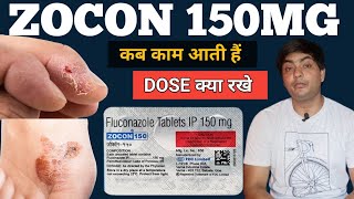 zocon 150  zocon 150 is used for in hindi  zocon 150 tablet  zocon 150 fluconazole [upl. by Cornall]