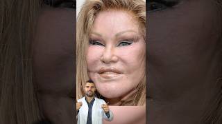 Jocelyn Wildenstein Früher vs Heute jocelynwildenstein katzenfrau frühervsheute beautydoc [upl. by Onaicnop]