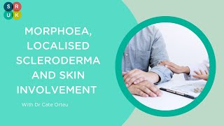 Webinar Morphoea Localised Scleroderma amp Skin Involvement [upl. by Pebrook275]