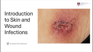 TOPIC 2  INTRODUCTION TO SKIN AND WOUND INFECTIONS [upl. by Lokcin910]