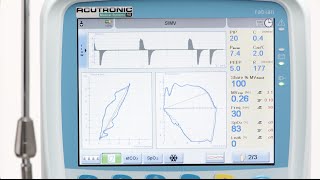 fabian HFO Waves and loops [upl. by Guss]