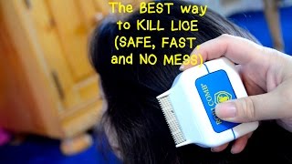 The BEST way to KILL LICE SAFE FAST and NO MESS [upl. by Floss]