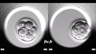 Evolution de deux embryons dans un Embryoscope [upl. by Kaylyn]