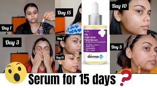 The Derma Co 2 Kojic Acid Face Serum  Treats Hyper Pigmentation  Dark Spots amp Blemishes JAHNABI [upl. by Crescentia]