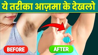 कालापन 15 Minute में दूर करे नैचरल तरीके से  Natural home remedies for body odour [upl. by Aillicec536]