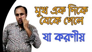 মুখ বাঁকা হয়ে গেলে ফিজিওথেরাপি চিকিৎসা। How to Remove Bells Palsy Facial Palsy [upl. by Shishko]