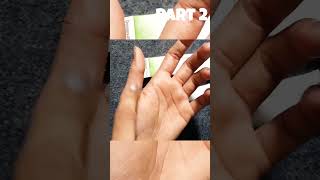 Dermovate cream for skin whitening beautytips P2 [upl. by Godwin]