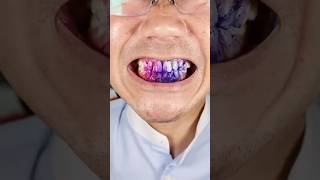 New Teeth Whiting Gum asmr dentist satisfying teethwhitening candy tasty [upl. by Mozelle886]