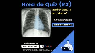 Anatomia radiográfica do tórax Silhueta cardíaca [upl. by Dorine792]