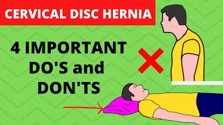 Cervical Herniated Disc Exercises to avoid Sleeping position Precautions [upl. by Gula240]