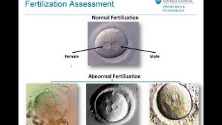 Embryo Selection and Transfer  Mass General Fertility Focus Webinar [upl. by Enelyam]