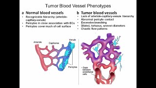 Targeting Cancer Pathways Tumor Metabolism and Proliferation [upl. by Uziel]