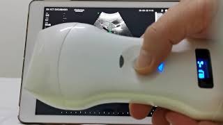 Double Probes Wireless Handheld Ultrasound ScannerD5CL [upl. by Aehtela583]