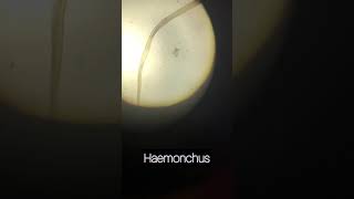 Haemonchus spp [upl. by Lucie185]