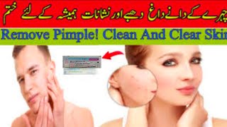 Fasoderm  f gel uses l best to remove acne amp pimple from skin l full review by aneespharmacist [upl. by Rebna]