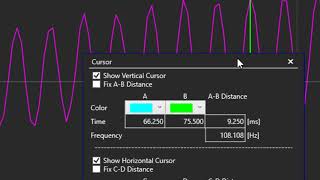 Stop High Pitched Sounds  Servo Tuning [upl. by Ynnep]