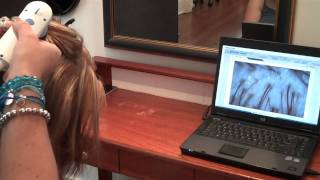 Hair Health Check amp Scalp Check with Brisbane Trichologist [upl. by Atsirk]