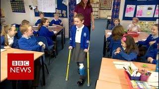 Girl walks into class on prosthetic leg  BBC News [upl. by Eydnarb937]